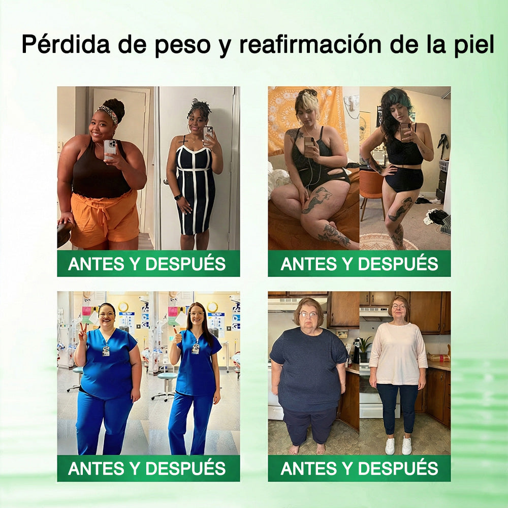 🥇🥇𝑻𝒊𝒆𝒏𝒅𝒂 𝑶𝒇𝒊𝒄𝒊𝒂𝒍 | GFOUK® 𝑴𝒐𝒓𝒊𝒏𝒈𝒂 · 𝑩𝒆𝒓𝒃𝒆𝒓𝒊𝒏𝒂 × 𝑵𝑨𝑫+ 𝑷𝒂𝒕𝒄𝒉 𝒂𝒗𝒂𝒏𝒛𝒂𝒅𝒐 𝟏𝟎-𝒆𝒏-𝟏 𝒄𝒐𝒏 𝒏𝒂𝒏𝒐 𝒎𝒊𝒄𝒓𝒐𝒂𝒈𝒖𝒋𝒂𝒔