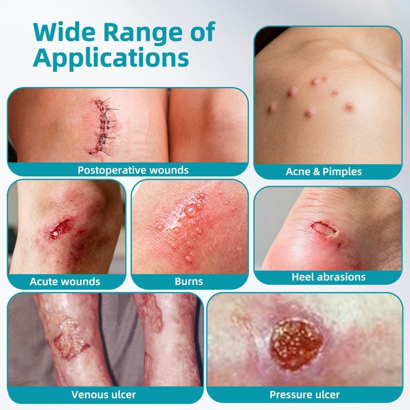 Dimora Med-Grade Hydrocolloid Roll Acne Patches | DIY Any Shape Acne Patch Roll | ultra waterproof, 2X Absorpt - image 5