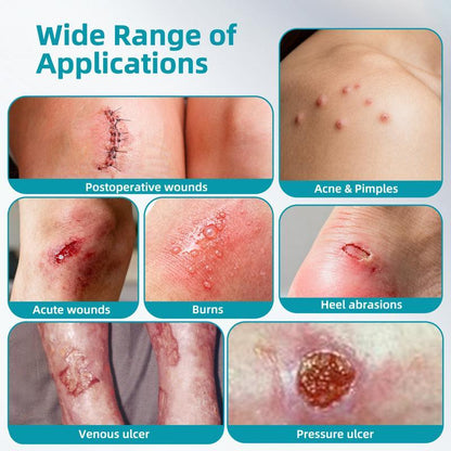 Dimora Med-Grade Hydrocolloid Roll Acne Patches | DIY Any Shape Acne Patch Roll | ultra waterproof, 2X Absorpt - image 5