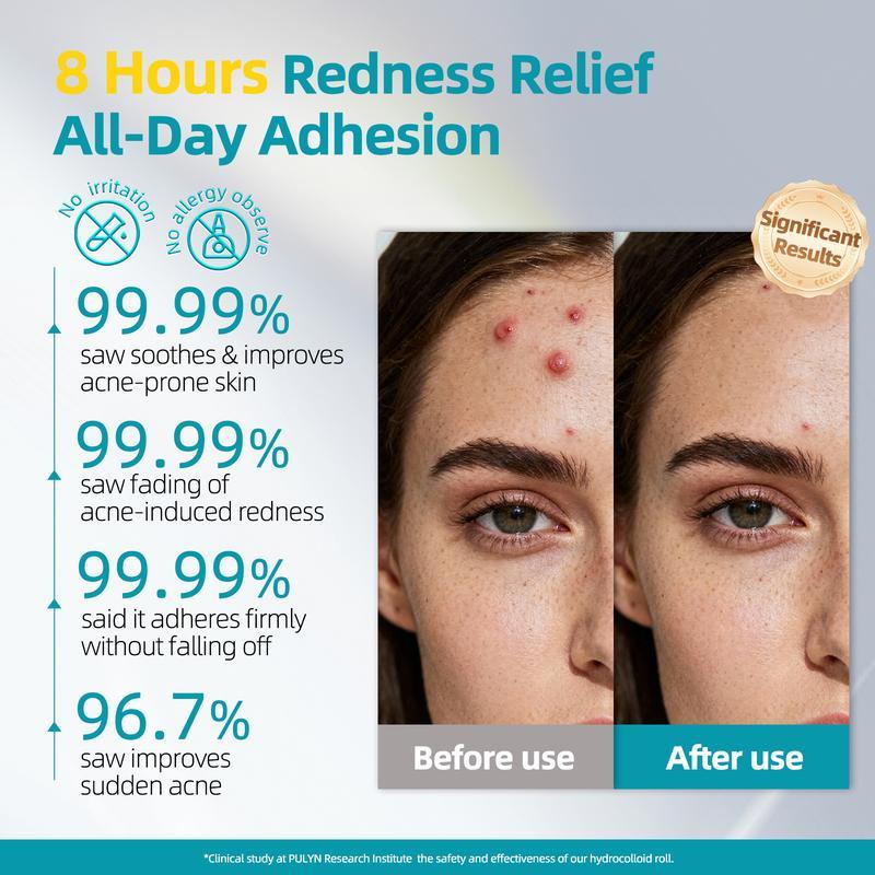 Dimora Med-Grade Hydrocolloid Roll Acne Patches | DIY Any Shape Acne Patch Roll | ultra waterproof, 2X Absorpt - image 4