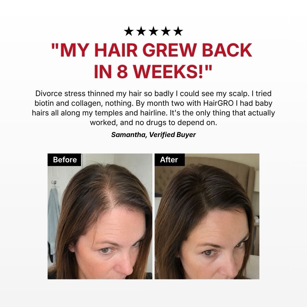 HairGRO™ 3-in-1 Hair Revival Brush