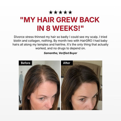 HairGRO™ 3-in-1 Hair Revival Brush