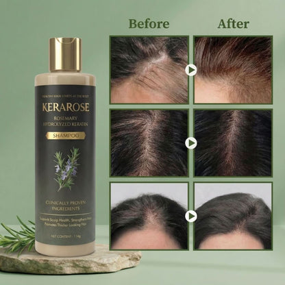 Kerarose™ Growth Support Shampoo