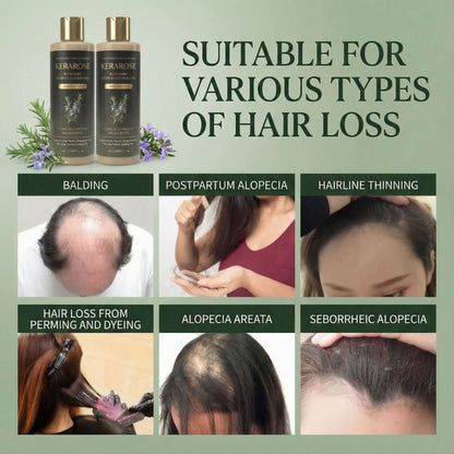 Kerarose™ Growth Support Shampoo