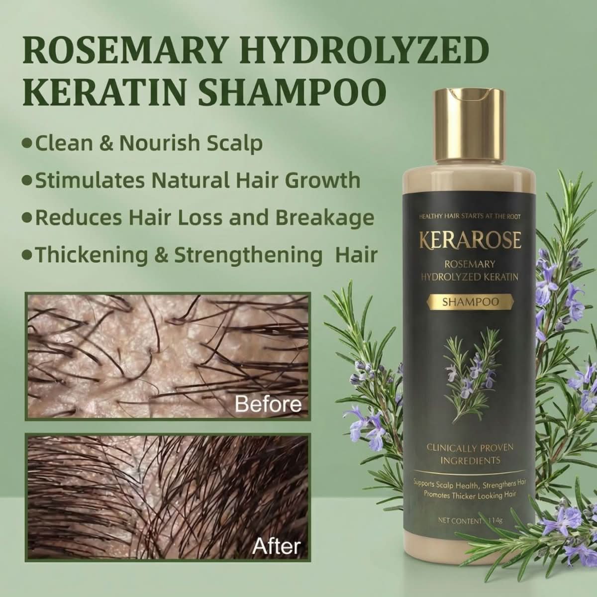 Kerarose™ Growth Support Shampoo